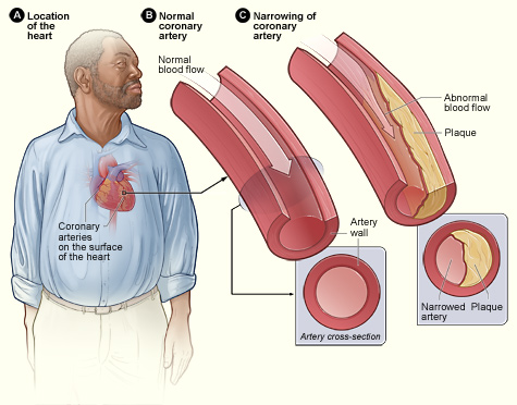 Cholesterol : the Good, the Bad and the Misunderstood