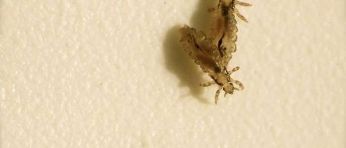head lice head lice
