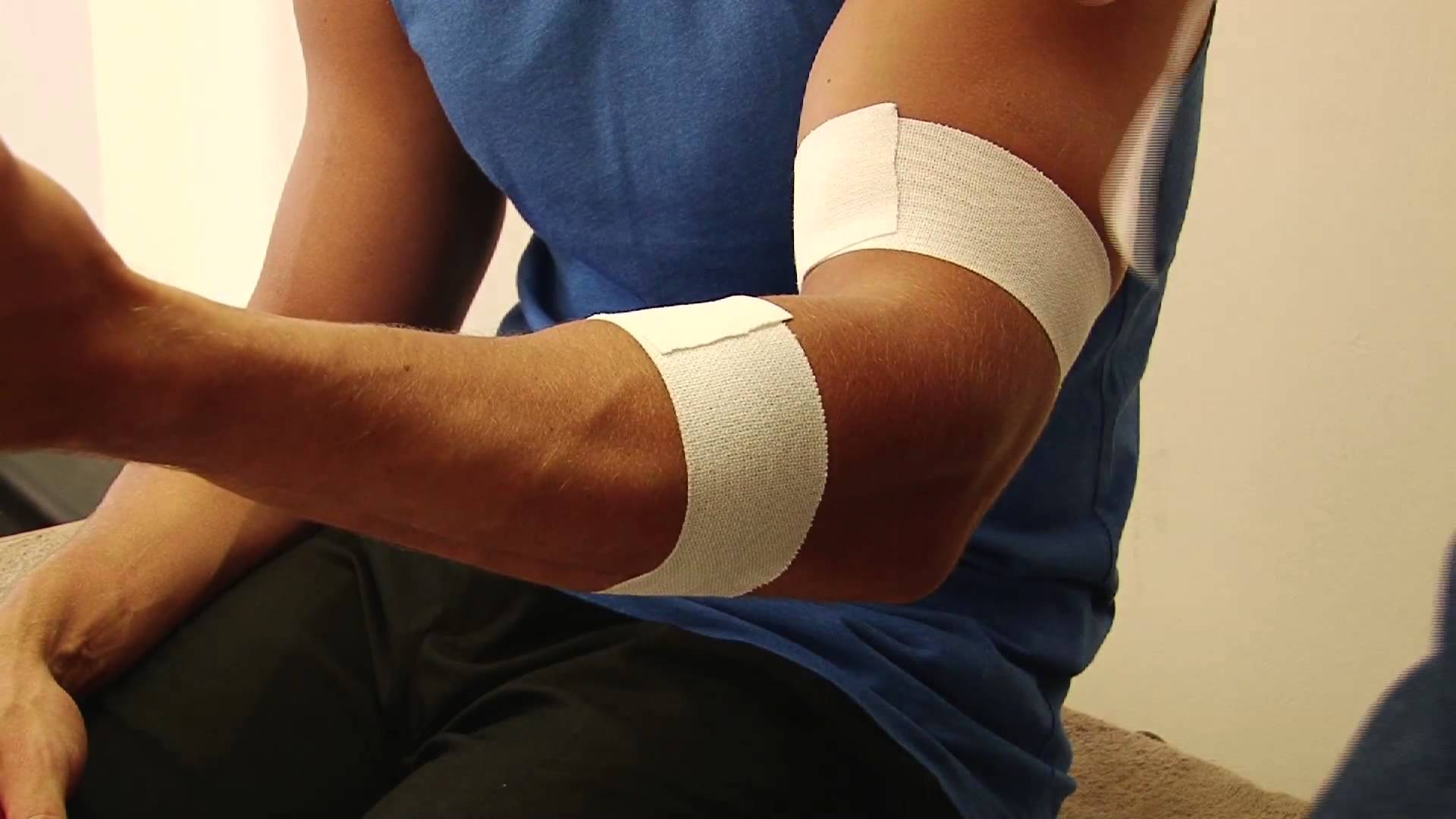 biceps-tendinitis