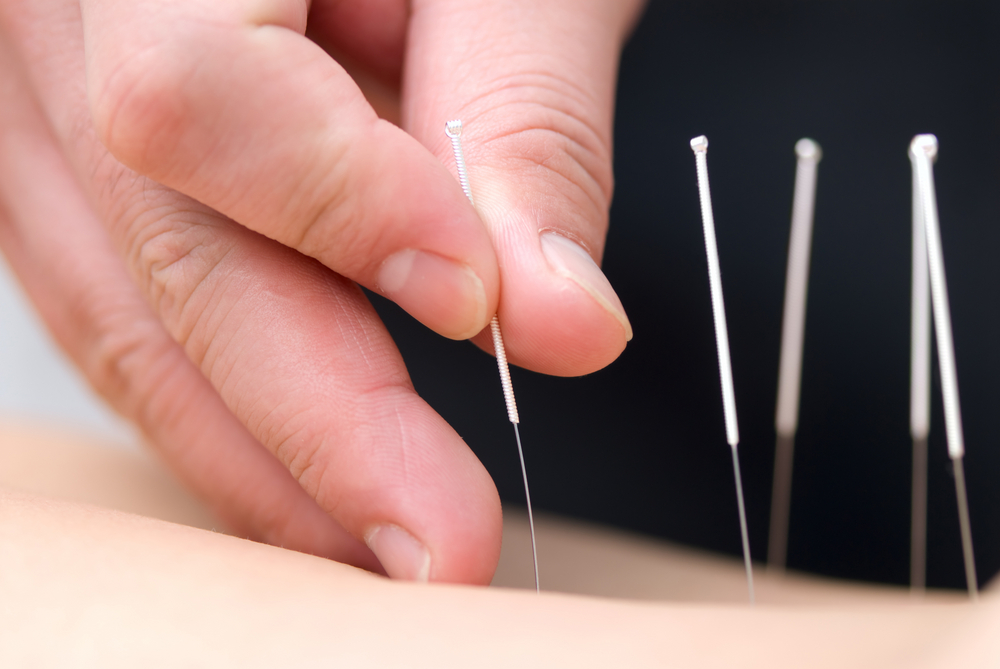 10 Recommended Acupuncturists in Jakarta