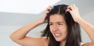 #Dandruff: What Are The Causes and How To Treat It